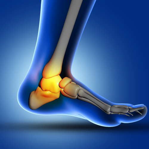 Heel And Foot Pain